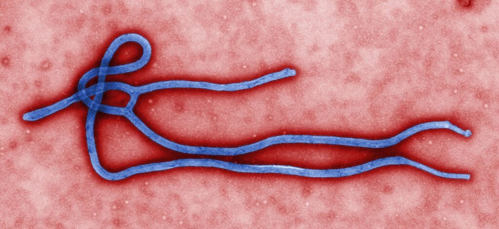 Image colorée au microscope électronique d’une particule du virus Ebola