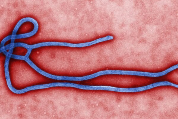 Image colorée au microscope électronique d’une particule du virus Ebola